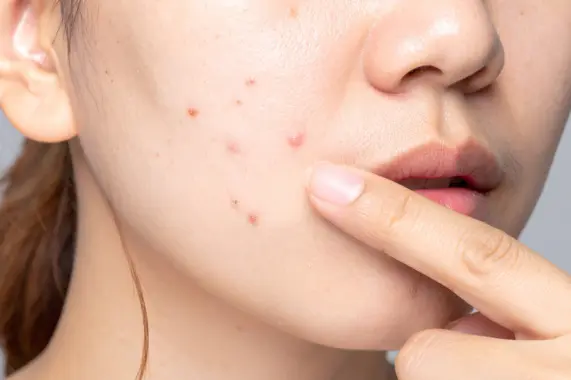 Alterações na Pele, Unhas ou Couro Cabeludo