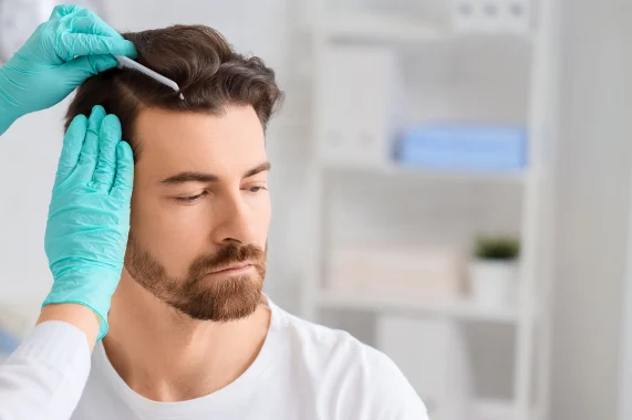 Tratamento para Queda de Cabelo